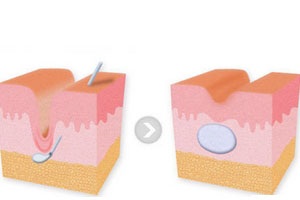 ע��������ƶ�ʲô������Ч?