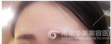 做纹眉有没有副作用呢?