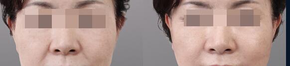 ע��**�����н�����