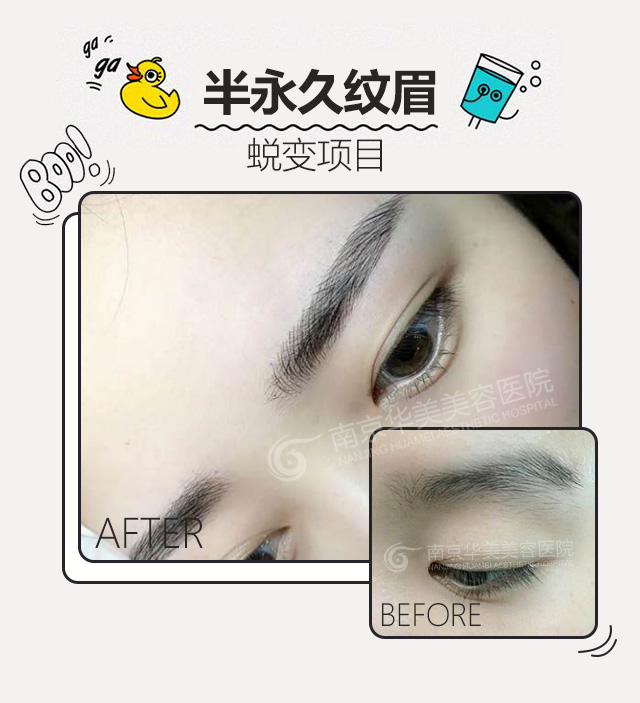 ��Ҫ����ü�Ͼ�����ҽԺ�ã�