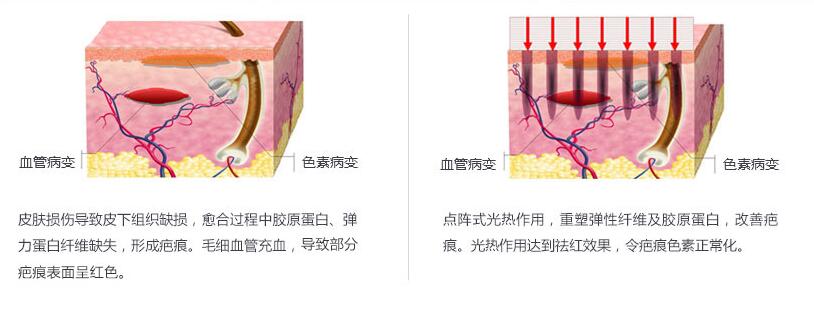 �Ͼ���������̺���Ҫ�����Σ�